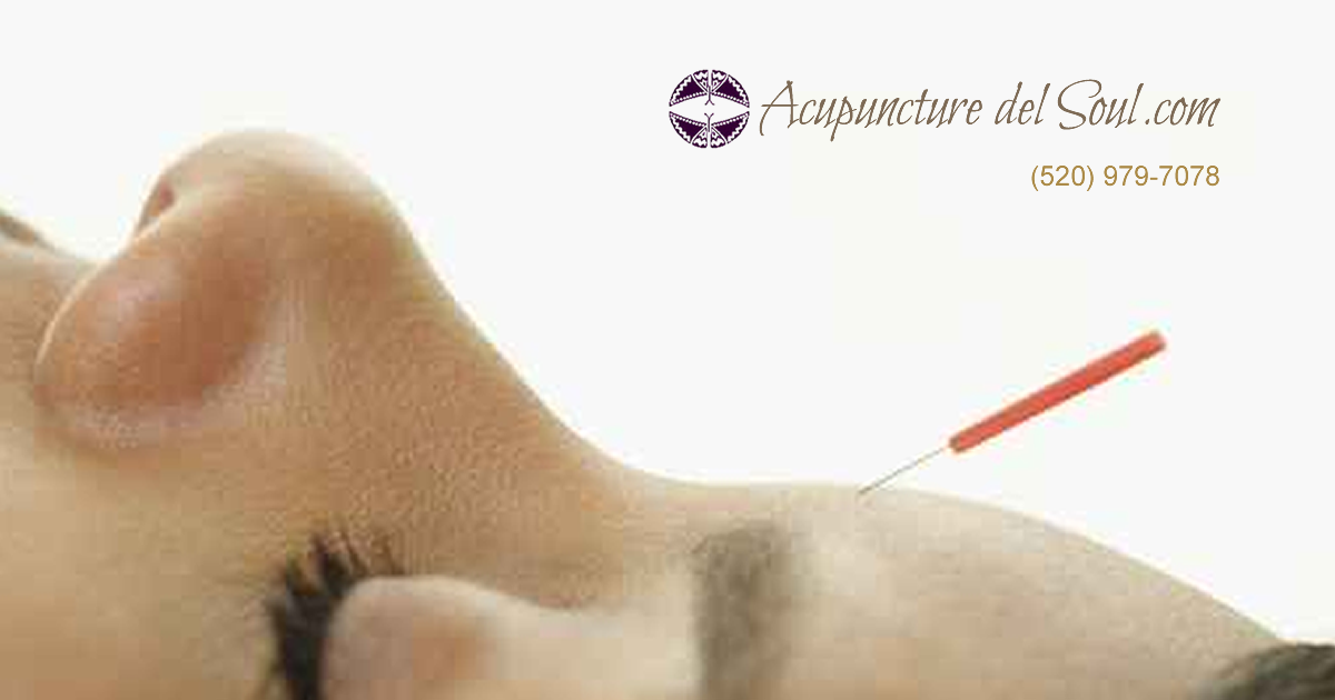 What conditions can acupuncture treat?