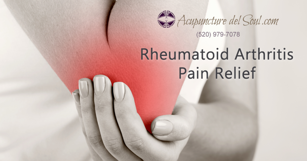 Rheumatoid Arthritis Pain Relief Acupuncture del Soul